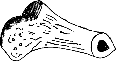 Illustration:
Fig. 9. Lower end of the thigh-bone sawn across, showing its central
cavity.