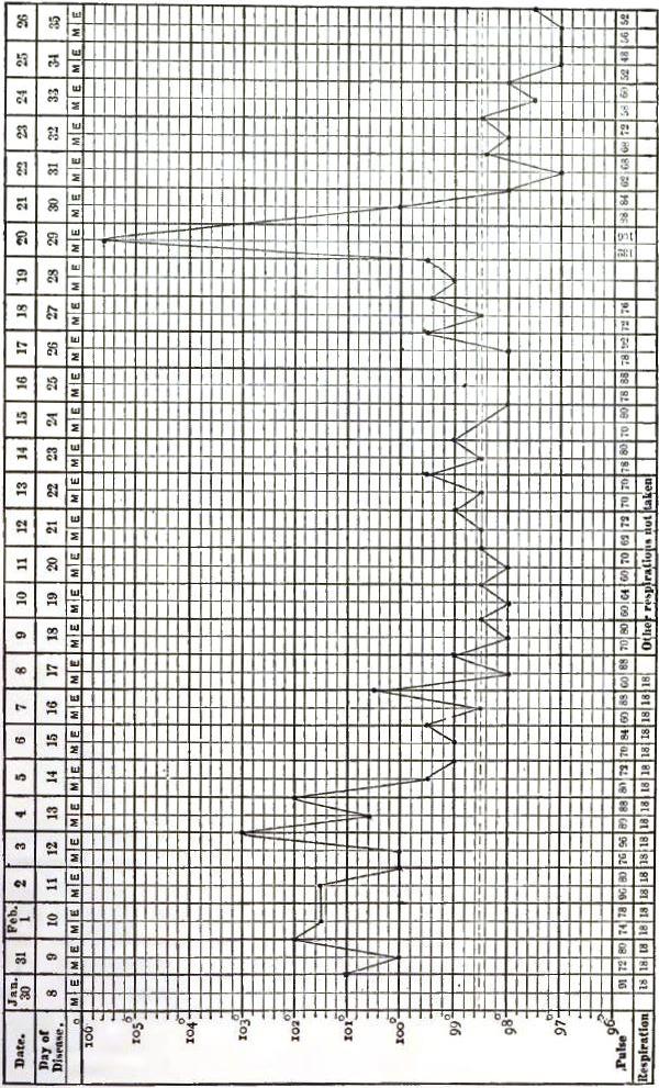 Recrudescenct typhoid temperature chart