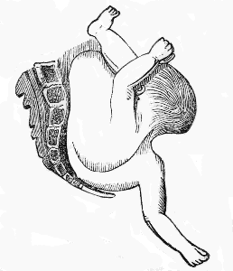 left
cephalo iliac position