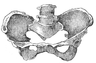 Ovate
Pelvis