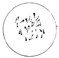 Bacillus of Diphtheria